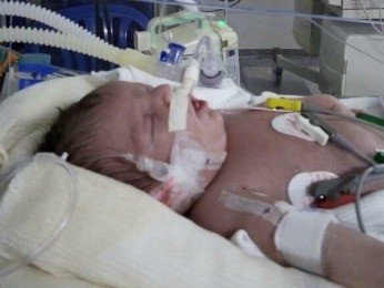 Família busca cirurgia para bebê com malformação no coração em MT
