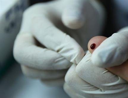Mato Grosso teve 713 casos de hepatites virais em 2019; SES alerta para prevenção e tratamento