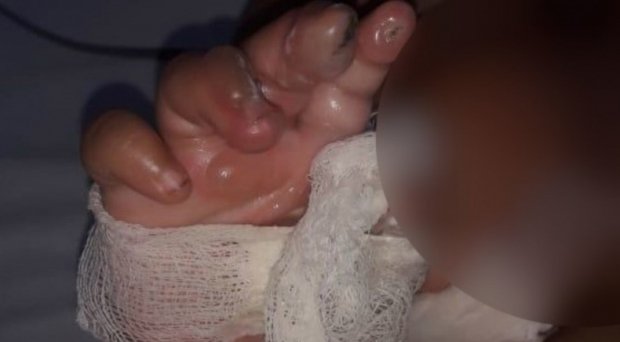 Bebê que levou choque ao pegar em carregador de celular conectado à tomada continua internado