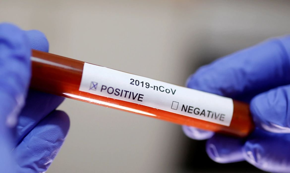 Fiocruz inicia distribuição de kits para diagnóstico do coronavírus