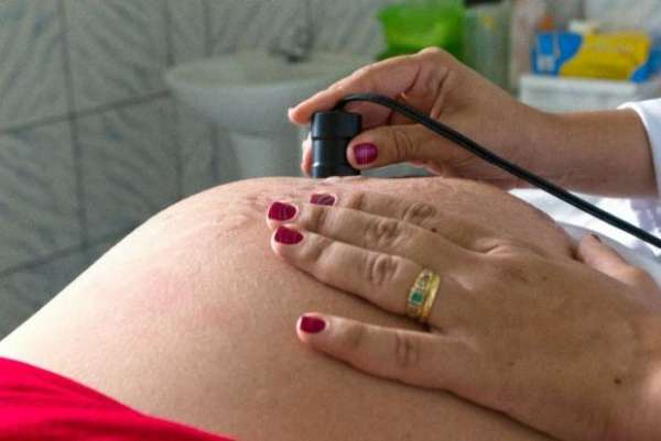 Pesquisa diz que grávidas acham exames do SUS insuficientes para microcefalia