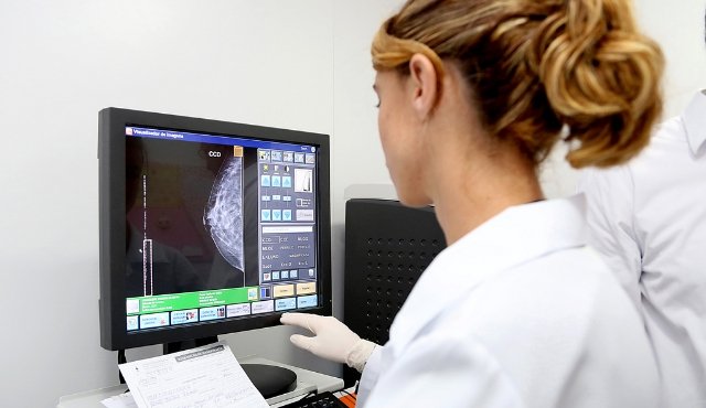 Mamografias periódicas evitam mortes por câncer de mama, diz estudo