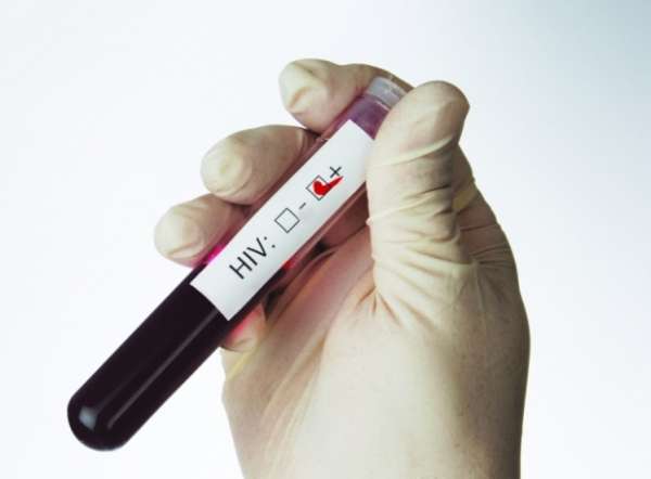 Portador do vírus HIV é curado no Reino Unido e anima pesquisadores