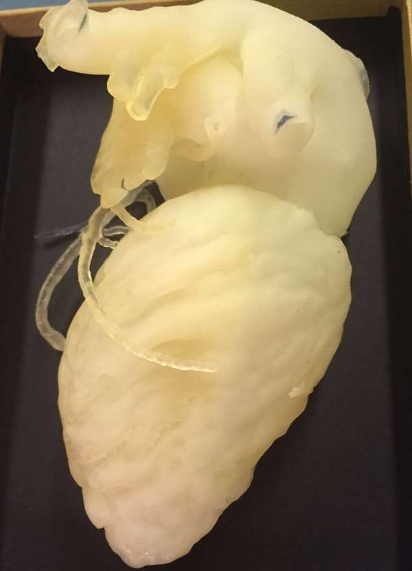 Médicos em SP estudam cirurgia com modelo de coração impresso em 3D