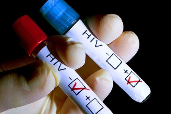 Em Lucas: 1,8% da população possui o vírus HIV