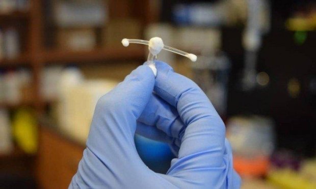 Novo implante vaginal ajuda a proteger mulheres do HIV