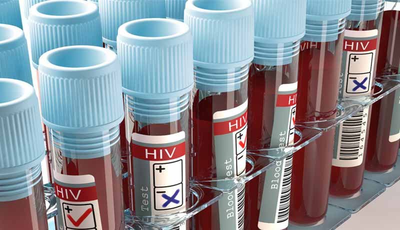 Empresa é condenada por mandar embora funcionário que descobriu ter vírus HIV