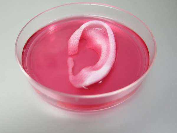 Cientistas criam orelha e mandíbula para implante em impressora 3D
