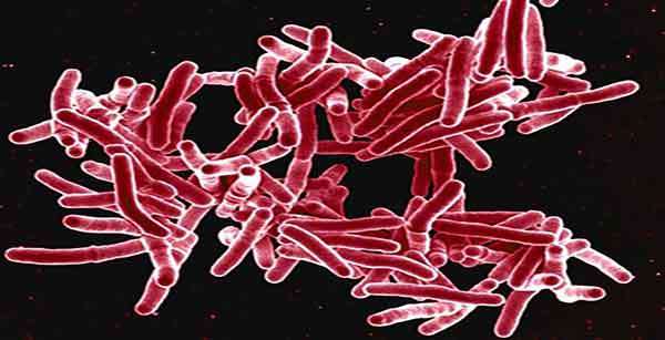 Tuberculose rivaliza com Aids em número de mortes, alerta OMS