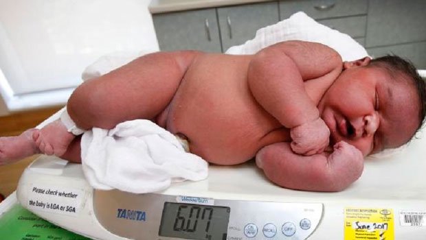 Bebê de 6kg e 57 centímetros nasce de parto normal e passa bem 