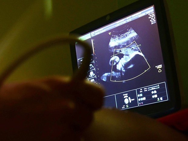 Com auxílio da Unicamp, OMS propõe novo parâmetro de crescimento fetal