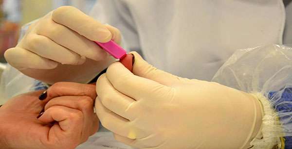 Teste rápido para detectar infecção pelo vírus da hepatite é incluído no SUS
