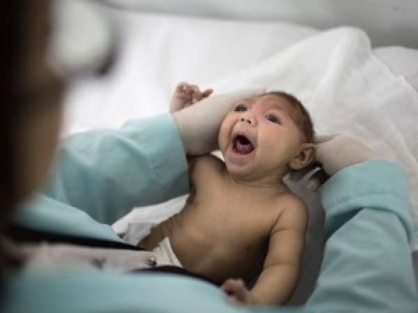 Crescem os casos de microcefalia provocados pelo vírus da zika em MT