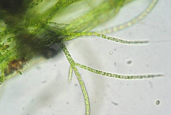 Vírus encontrado em algas altera capacidade mental de humanos