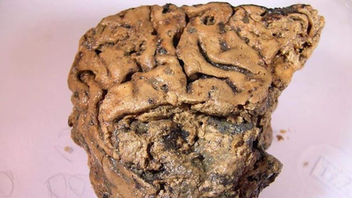 Tecido cerebral humano sobrevive intacto por 2.600 anos; veja como