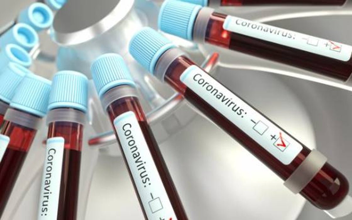  Coronavírus: Ministério vai permitir que médicos usem remédio da malária em pacientes graves 
