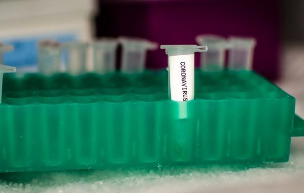 Instituto belga neutraliza coronavírus em laboratório 