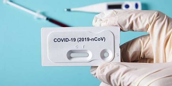 Mais um caso de COVID 19 é registrado em Colniza – MT