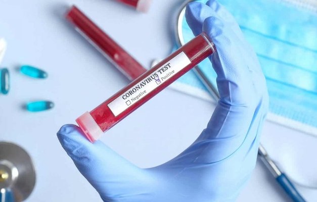 Secretaria de Saúde registra primeiro caso suspeito de corontivirus em Juruena