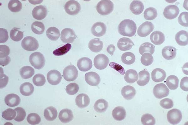 Cientistas identificam novo composto para o tratamento da malária