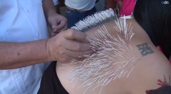 Ativista espeta 2.500 agulhas nas costas para protestar