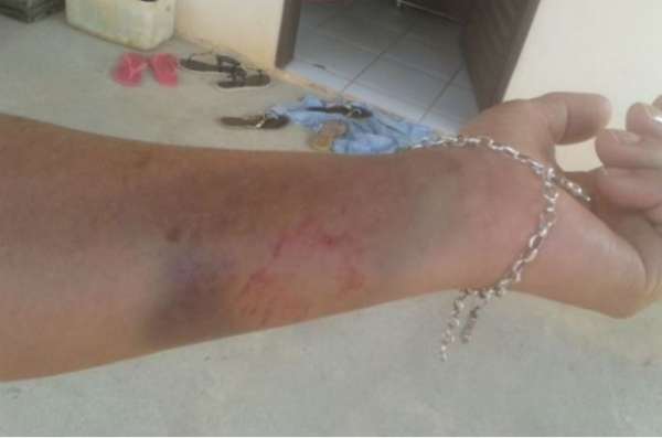 Cão ataca mulher durante entrega de >santinhos> em Alta Floresta